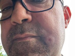 2024-10-27 MISSÃO ROSA